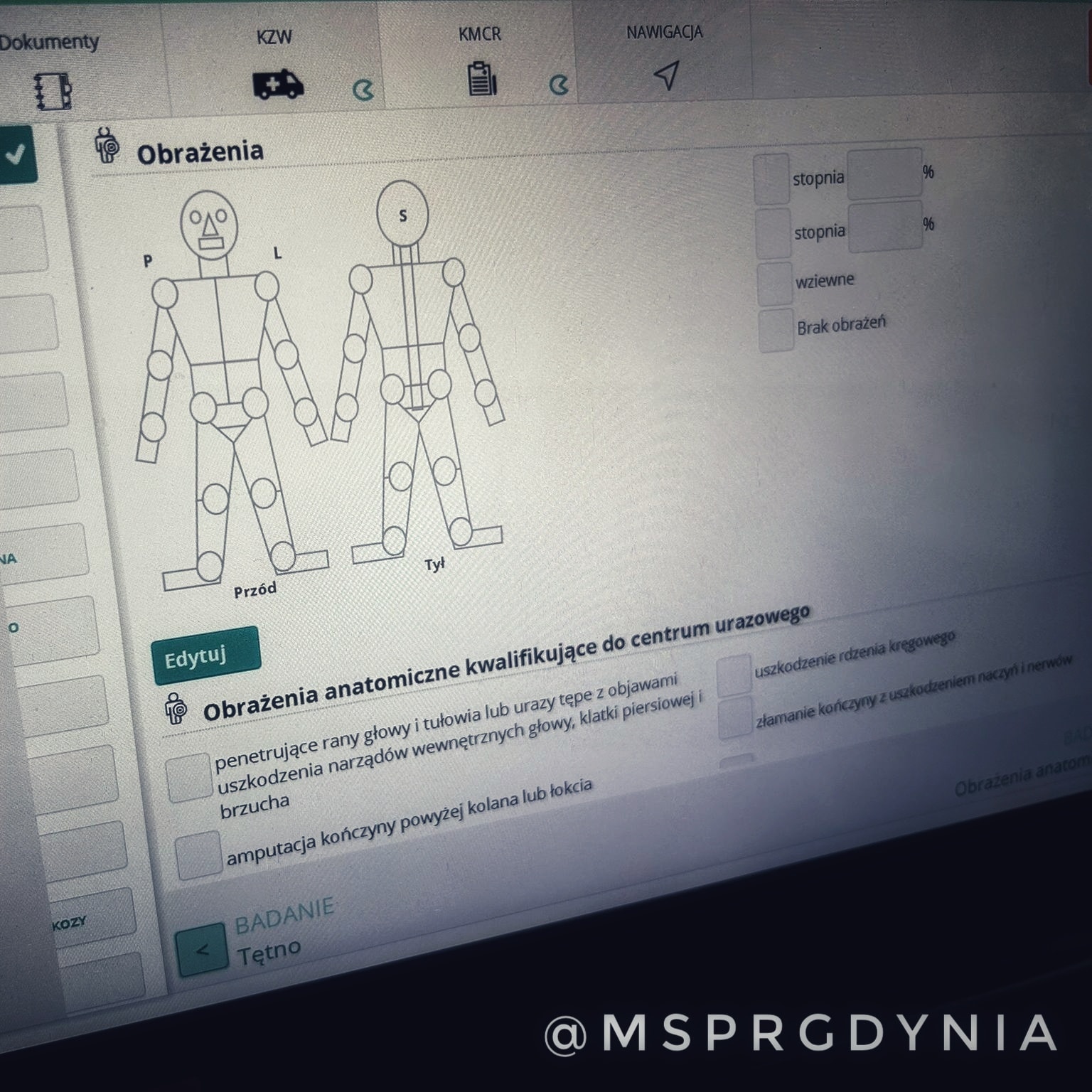 Dramat na śliskim chodniku. Uderzył głową o lód i zemdlał