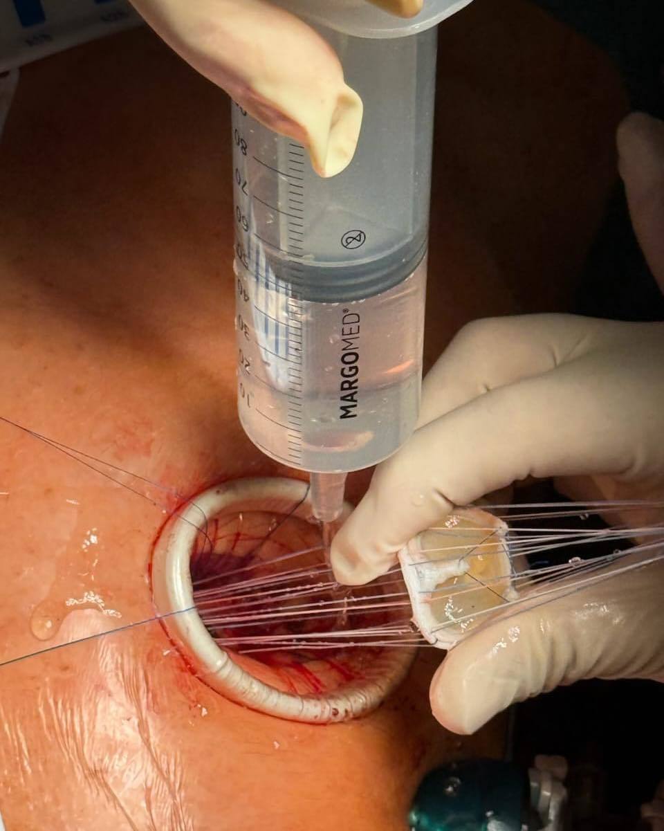 Fot. Szpital Specjalistyczny im F. Ceynowy w Wejherowie 