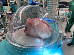 'Game changer' w transplantologii. Lekarze regenerują płuca przed przeszczepem