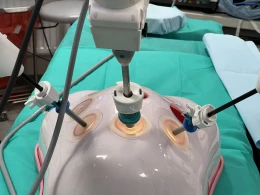 W Pucku testowali nowy sprzęt do chirurgii robotowej. Ma pomóc m.in. w skróceniu czasu hospitalizacji 